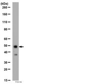 Anti-Glycine Receptor α3 subunit Antibody Chemicon®, from rabbit
