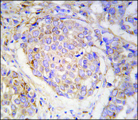 Anti-MAGEA10 (C-term) antibody produced in rabbit IgG fraction of antiserum, buffered aqueous solution