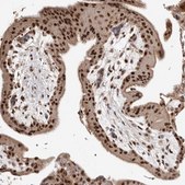 Anti-NCOA3 antibody produced in rabbit Prestige Antibodies® Powered by Atlas Antibodies, affinity isolated antibody, buffered aqueous glycerol solution