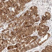 Anti-DTNBP1 antibody produced in rabbit Prestige Antibodies® Powered by Atlas Antibodies, affinity isolated antibody, buffered aqueous glycerol solution, ab3