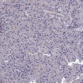 Anti-ADAM11 Prestige Antibodies® Powered by Atlas Antibodies, affinity isolated antibody