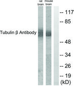 Anti-Tubulin β antibody produced in rabbit affinity isolated antibody