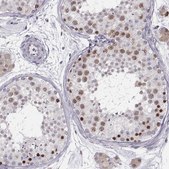 Anti-SCML2 antibody produced in rabbit Prestige Antibodies® Powered by Atlas Antibodies, affinity isolated antibody