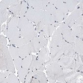 Anti-SREK1 antibody produced in rabbit Prestige Antibodies® Powered by Atlas Antibodies, affinity isolated antibody, buffered aqueous glycerol solution