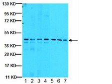 Anti-Casein Kinase 2α Antibody, 1AD9 clone 1AD9, from mouse
