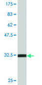 Monoclonal Anti-CHFR antibody produced in mouse clone 2B11, purified immunoglobulin, buffered aqueous solution