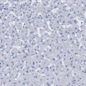 Anti-P2RY12 antibody produced in rabbit Prestige Antibodies® Powered by Atlas Antibodies, affinity isolated antibody, buffered aqueous glycerol solution