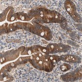 Anti-SDC4 antibody produced in rabbit Prestige Antibodies® Powered by Atlas Antibodies, affinity isolated antibody, buffered aqueous glycerol solution