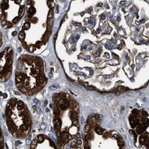 Anti-GSTP1 antibody produced in rabbit Prestige Antibodies® Powered by Atlas Antibodies, affinity isolated antibody, buffered aqueous glycerol solution, Ab1