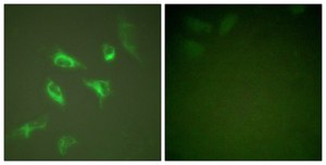 Anti-14-3-3 ζ antibody produced in rabbit affinity isolated antibody