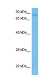 Anti-NOTCH1 antibody produced in rabbit affinity isolated antibody