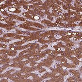 Anti-SLC27A2 antibody produced in rabbit Prestige Antibodies® Powered by Atlas Antibodies, affinity isolated antibody, buffered aqueous glycerol solution