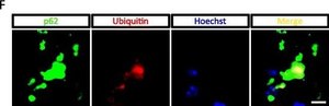 Anti-Ubiquitin Antibody, clone Ubi-1 (aka 042691GS) ascites fluid, clone Ubi-1 (042691GS), Chemicon®