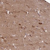 Anti-FUNDC1 antibody produced in rabbit Prestige Antibodies® Powered by Atlas Antibodies, affinity isolated antibody, buffered aqueous glycerol solution