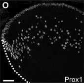 Anti-Prox 1 Antibody serum, Chemicon®