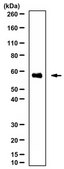 Anti-Methyltransferase-like protein 13 Antibody from rabbit, purified by affinity chromatography