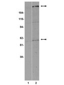Anti-Frizzled 5 Antibody Upstate®, from rabbit