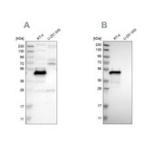 Anti-TES antibody produced in rabbit Prestige Antibodies® Powered by Atlas Antibodies, affinity isolated antibody, buffered aqueous glycerol solution