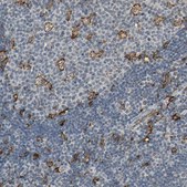 Anti-SKAP2 antibody produced in rabbit Prestige Antibodies® Powered by Atlas Antibodies, affinity isolated antibody, buffered aqueous glycerol solution