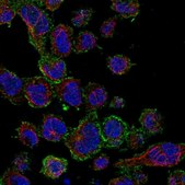 Anti-SAMSN1 antibody produced in rabbit Prestige Antibodies® Powered by Atlas Antibodies, affinity isolated antibody, buffered aqueous glycerol solution
