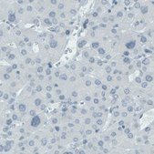 Monoclonal Anti-SLC27A5 antibody produced in mouse Prestige Antibodies® Powered by Atlas Antibodies, clone CL0216, purified immunoglobulin, buffered aqueous glycerol solution