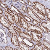 Anti-MRPS12 antibody produced in rabbit Prestige Antibodies® Powered by Atlas Antibodies, affinity isolated antibody, buffered aqueous glycerol solution