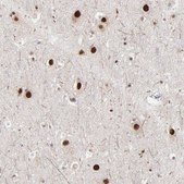 Anti-ZNF3 antibody produced in rabbit Prestige Antibodies® Powered by Atlas Antibodies, affinity isolated antibody, buffered aqueous glycerol solution