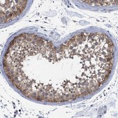 Anti-FHOD3 antibody produced in rabbit Prestige Antibodies® Powered by Atlas Antibodies, affinity isolated antibody, buffered aqueous glycerol solution, Ab1