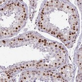 Anti-CDYL antibody produced in rabbit Prestige Antibodies® Powered by Atlas Antibodies, affinity isolated antibody, buffered aqueous glycerol solution