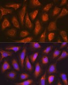 Anti-SOCS2 antibody produced in rabbit