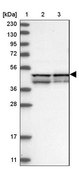 Anti-RMDN2 antibody produced in rabbit Prestige Antibodies® Powered by Atlas Antibodies, affinity isolated antibody, buffered aqueous glycerol solution