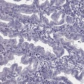 Anti-CRISP1 antibody produced in rabbit Prestige Antibodies® Powered by Atlas Antibodies, affinity isolated antibody, buffered aqueous glycerol solution