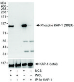 Rabbit anti-Phospho KAP-1 (S824) Antibody, Affinity Purified Powered by Bethyl Laboratories, Inc.