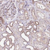 Anti-LIMCH1 antibody produced in rabbit Prestige Antibodies® Powered by Atlas Antibodies, affinity isolated antibody, buffered aqueous glycerol solution