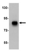 Anti-TCF12 Antibody from rabbit, purified by affinity chromatography