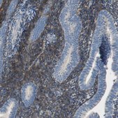 Anti-ALDH1A2 antibody produced in rabbit Prestige Antibodies® Powered by Atlas Antibodies, affinity isolated antibody, buffered aqueous glycerol solution