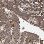 Anti-MRPL10 antibody produced in rabbit Prestige Antibodies® Powered by Atlas Antibodies, affinity isolated antibody, buffered aqueous glycerol solution