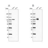 Anti-ITGB2 antibody produced in rabbit Prestige Antibodies® Powered by Atlas Antibodies, affinity isolated antibody, buffered aqueous glycerol solution