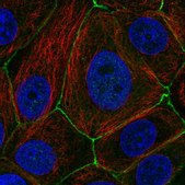 Anti-PAK4 antibody produced in rabbit Prestige Antibodies® Powered by Atlas Antibodies, affinity isolated antibody