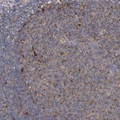 Anti-BCL2L12 antibody produced in rabbit Prestige Antibodies® Powered by Atlas Antibodies, affinity isolated antibody, buffered aqueous glycerol solution
