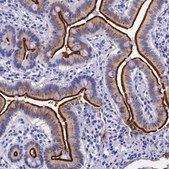 Anti-ACE2 antibody produced in rabbit Prestige Antibodies® Powered by Atlas Antibodies, affinity isolated antibody, buffered aqueous glycerol solution