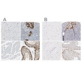 Anti-ASB9 antibody produced in rabbit Ab2, Prestige Antibodies® Powered by Atlas Antibodies, affinity isolated antibody, buffered aqueous glycerol solution