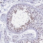 Anti-KLF14 antibody produced in rabbit Prestige Antibodies® Powered by Atlas Antibodies, affinity isolated antibody, buffered aqueous glycerol solution