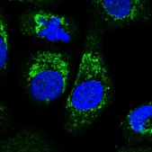 Anti-ALDH16A1 antibody produced in rabbit Prestige Antibodies® Powered by Atlas Antibodies, affinity isolated antibody, buffered aqueous glycerol solution