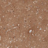 Anti-THY1 antibody produced in rabbit Prestige Antibodies® Powered by Atlas Antibodies, affinity isolated antibody, buffered aqueous glycerol solution