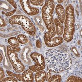 Anti-PGRMC1 antibody produced in rabbit Prestige Antibodies® Powered by Atlas Antibodies, affinity isolated antibody, buffered aqueous glycerol solution