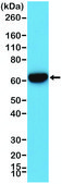 Anti-CK-5/CK-6 (Cytokeratin 5/ Cytokeratin 6) antibody, Rabbit monoclonal recombinant, expressed in HEK 293 cells, clone RM341, purified immunoglobulin