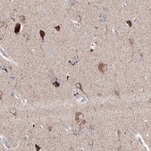 Anti-GLS antibody produced in rabbit Prestige Antibodies® Powered by Atlas Antibodies, affinity isolated antibody, buffered aqueous glycerol solution