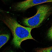 Anti-PLCG1 antibody produced in rabbit Prestige Antibodies® Powered by Atlas Antibodies, affinity isolated antibody, buffered aqueous glycerol solution