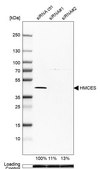Anti-HMCES antibody produced in rabbit Prestige Antibodies® Powered by Atlas Antibodies, affinity isolated antibody, buffered aqueous glycerol solution